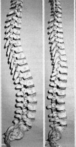 脊柱の生理的弯曲とフラットバック